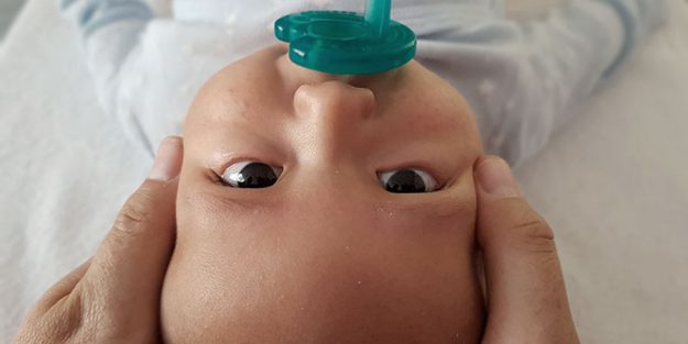 plagiocefalia banner